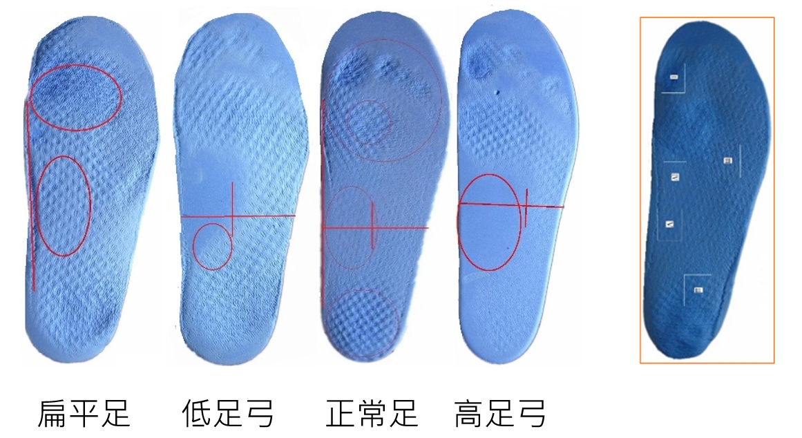 MP-1 壓力分析圖