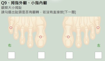 檢測畫面-拇趾外翻,小趾內翻