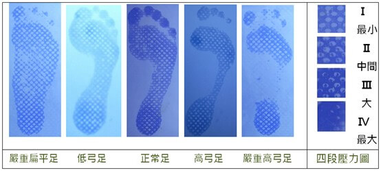 MP-5 感壓式足印器-嚴重扁平足至嚴重高足弓之四段壓力圖範例