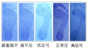 足型足壓隱藏的健康密碼