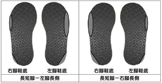 長短腳左右腳鞋底磨損位置與長側特徵解析