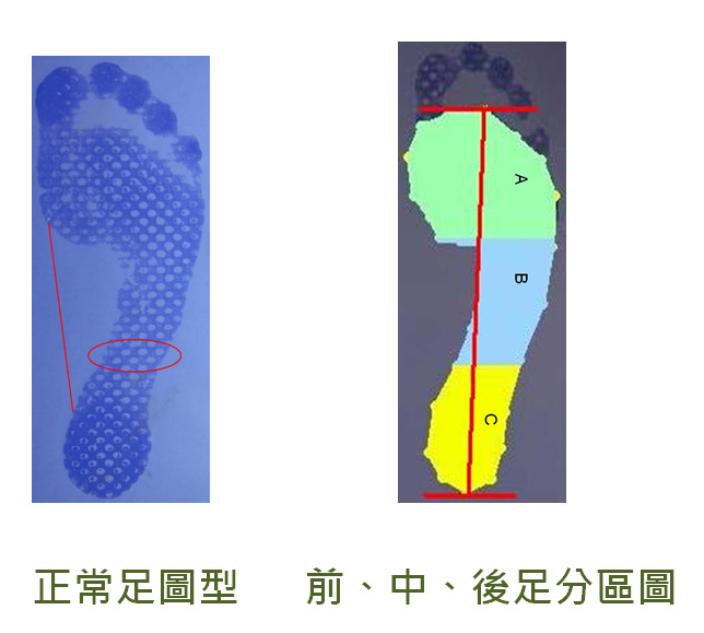 正常足型與足部分區檢測圖